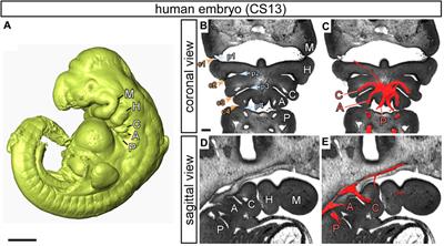 Morphogenetic processes in the development and evolution of the arteries of the pharyngeal arches: their relations to congenital cardiovascular malformations